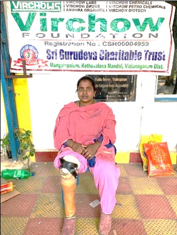 PHYSICALLY CHALLENGED-SUCCESS STORY:01